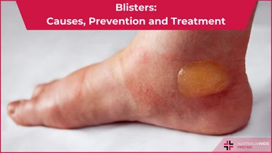 Blister article header